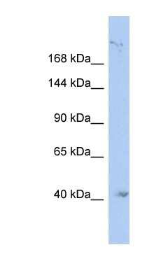 Western Blot: KIF1A Antibody [NBP1-80033]