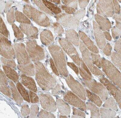 Immunohistochemistry-Paraffin: KIF1C Antibody [NBP1-85978]