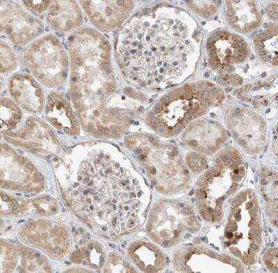 Immunohistochemistry-Paraffin: KIF1C Antibody [NBP1-85978]