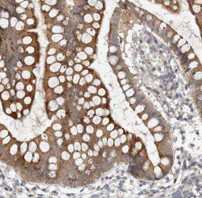 Immunohistochemistry-Paraffin: KIF1C Antibody [NBP1-85978]