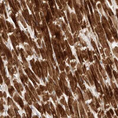 Immunohistochemistry-Paraffin: KIF1C Antibody [NBP1-85978]