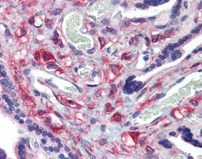 Immunohistochemistry: KIF20A Antibody [NBP2-87689]