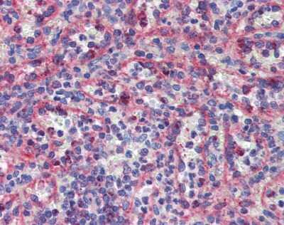 Immunohistochemistry: KIF20A Antibody [NBP2-87689]
