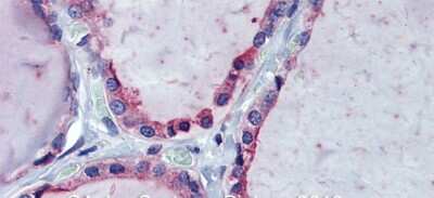 Immunohistochemistry: KIF20A Antibody [NBP2-87689]