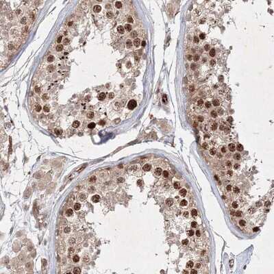 Immunohistochemistry-Paraffin: KIF20A Antibody [NBP1-87175]