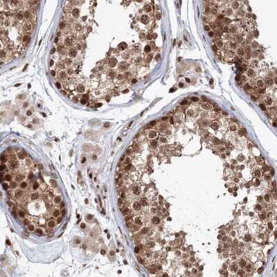 Immunohistochemistry-Paraffin: KIF20A Antibody [NBP1-87176]