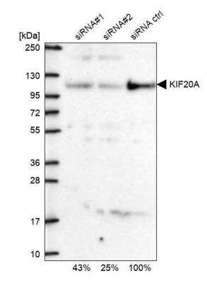 Western Blot: KIF20A Antibody [NBP1-87176]