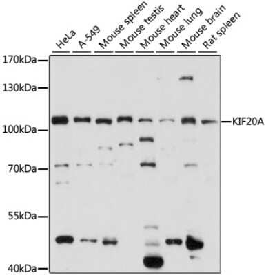 Western Blot: KIF20A AntibodyAzide and BSA Free [NBP3-05117]