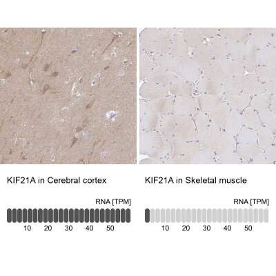 Immunohistochemistry-Paraffin: KIF21A Antibody [NBP2-37969]