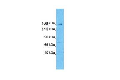 Western Blot: KIF21A Antibody [NBP1-58143]