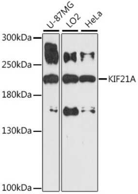 Western Blot: KIF21A AntibodyAzide and BSA Free [NBP3-04389]