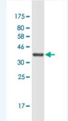 Western Blot: KIF21B Antibody (4C12) [H00023046-M03-100ug]