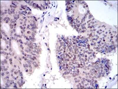 Immunohistochemistry-Paraffin: KIF22 Antibody (1E3) - BSA Free [NBP2-37550]