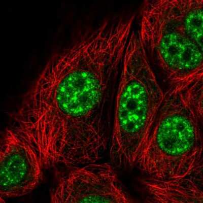 Immunocytochemistry/ Immunofluorescence: KIF22 Antibody [NBP2-57459]