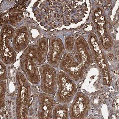 Immunohistochemistry-Paraffin: KIF22 Antibody [NBP1-82876]