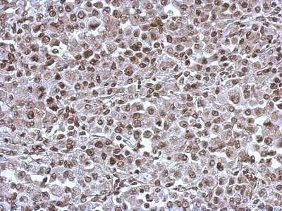 Immunohistochemistry-Paraffin: KIF22 Antibody [NBP2-17053]