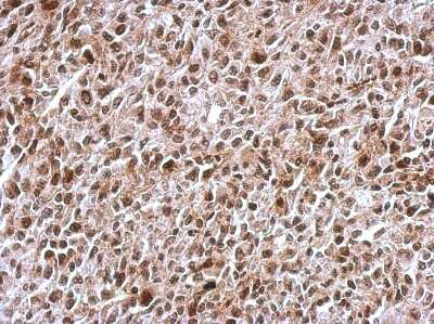 Immunohistochemistry-Paraffin: KIF22 Antibody [NBP2-17053]