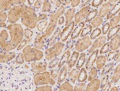 Immunohistochemistry-Paraffin: KIF22 Antibody [NBP3-12640]