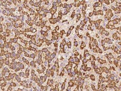 Immunohistochemistry-Paraffin: KIF22 Antibody [NBP3-12640]