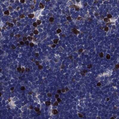 Immunohistochemistry-Paraffin: KIF22 Antibody [NBP3-17728]