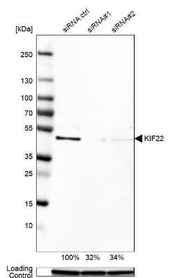 Western Blot: KIF22 Antibody [NBP1-82876]