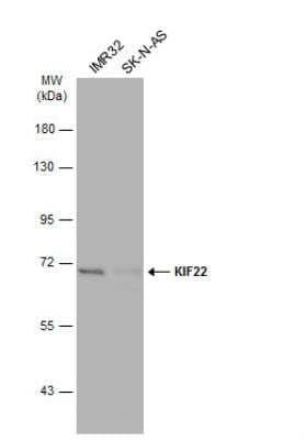 Western Blot: KIF22 Antibody [NBP2-17053]