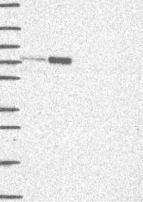 Western Blot: KIF22 Antibody [NBP3-17728]