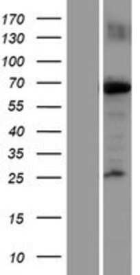 Western Blot: KIF22 Overexpression Lysate [NBP2-07509]