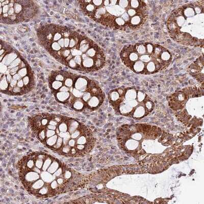 Immunohistochemistry-Paraffin: KIF25 Antibody [NBP1-92055]