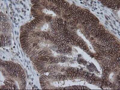Immunohistochemistry: KIF25 Antibody (OTI2F4) - Azide and BSA Free [NBP2-71077]