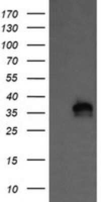 Western Blot: KIF25 Antibody (OTI2F4)Azide and BSA Free [NBP2-71077]