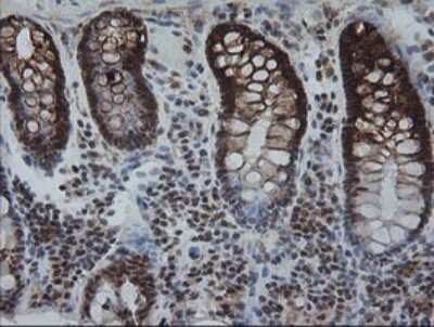 Immunohistochemistry: KIF25 Antibody (OTI2F4) [NBP2-45768]