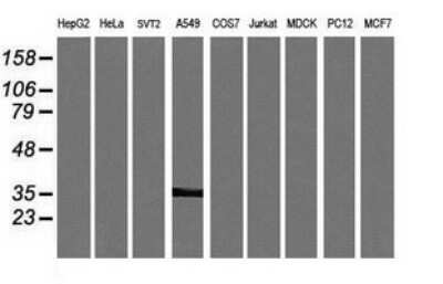 Western Blot: KIF25 Antibody (OTI2F4) [NBP2-45768]