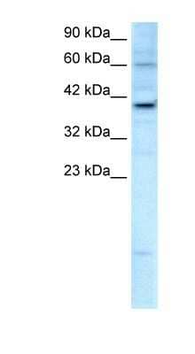 Western Blot: KIF25 Antibody [NBP1-80034]