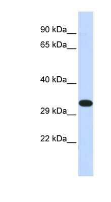 Western Blot: KIF25 Antibody [NBP1-80035]