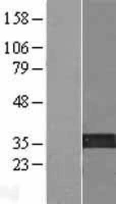 Western Blot: KIF25 Overexpression Lysate [NBP2-07761]