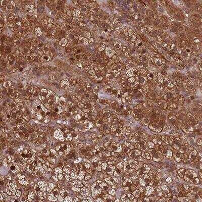 Immunohistochemistry-Paraffin: KIF26A Antibody [NBP2-14158]