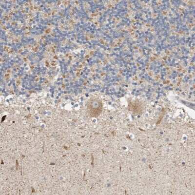 Immunohistochemistry-Paraffin: KIF26B Antibody [NBP1-90445]