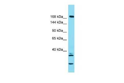 Western Blot: KIF27 Antibody [NBP3-10310]