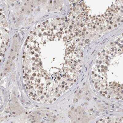 Immunohistochemistry-Paraffin: KIF2B Antibody [NBP1-86002]