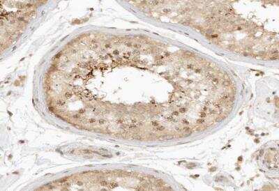 Immunohistochemistry-Paraffin: KIF2B Antibody [NBP1-86416]