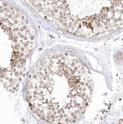 Immunohistochemistry-Paraffin: KIF2B Antibody [NBP1-89446]