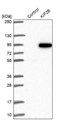 Western Blot: KIF2B Antibody [NBP1-89446]