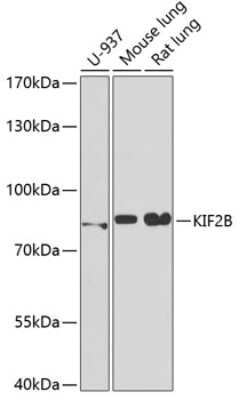 Western Blot: KIF2B AntibodyBSA Free [NBP3-05100]