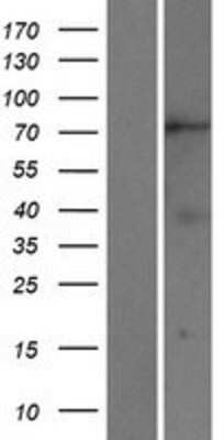 Western Blot: KIF2B Overexpression Lysate [NBP2-06003]