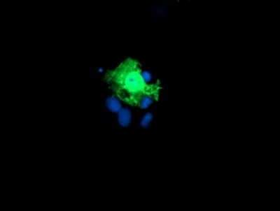 Immunocytochemistry/ Immunofluorescence: KIF2C Antibody (OTI1C5) - Azide and BSA Free [NBP2-71667]