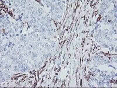 Immunohistochemistry: KIF2C Antibody (OTI1C5) - Azide and BSA Free [NBP2-71667]