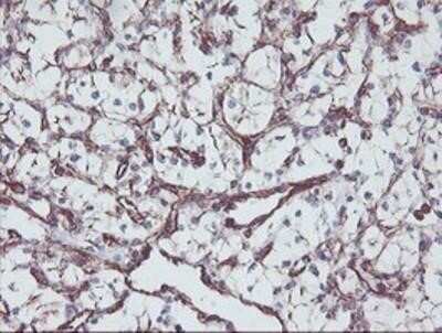 Immunohistochemistry: KIF2C Antibody (OTI1C5) - Azide and BSA Free [NBP2-71667]