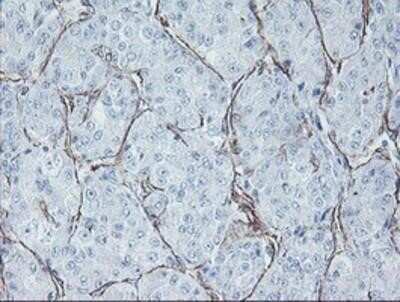 Immunohistochemistry: KIF2C Antibody (OTI1C5) - Azide and BSA Free [NBP2-71667]