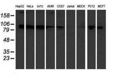 Western Blot: KIF2C Antibody (OTI1C5)Azide and BSA Free [NBP2-71667]